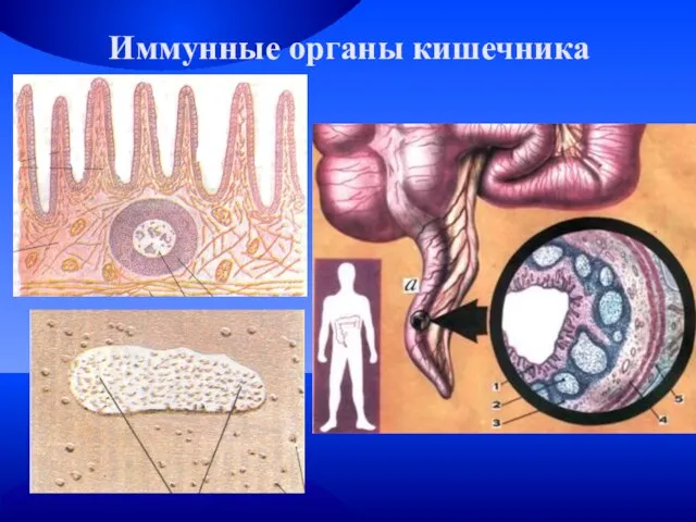 Иммунные органы кишечника