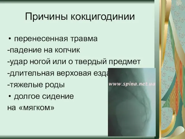 Причины кокцигодинии перенесенная травма -падение на копчик -удар ногой или о твердый