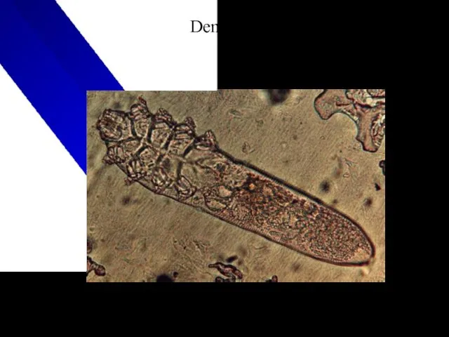 Demodex