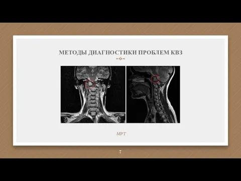 МЕТОДЫ ДИАГНОСТИКИ ПРОБЛЕМ КВЗ МРТ