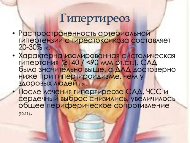 Гипертиреоз Распространенность артериальной гипертензии с тиреотоксикоза составляет 20-30% (9). Характерна изолированная систолическая