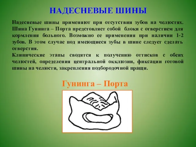 НАДЕСНЕВЫЕ ШИНЫ Надесневые шины применяют при отсутствии зубов на челюстях. Шина Гунинга