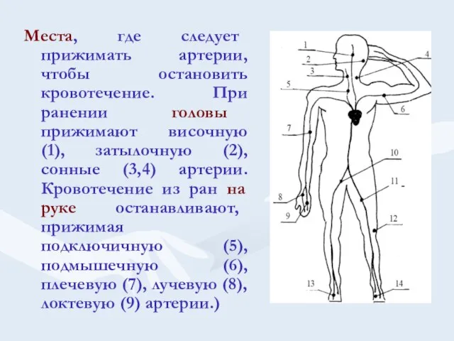 Места, где следует прижимать артерии, чтобы остановить кровотечение. При ранении головы прижимают