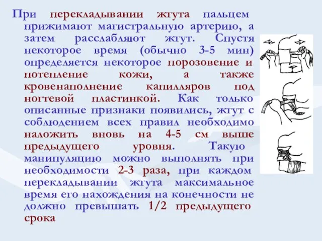 При перекладывании жгута пальцем прижимают магистральную артерию, а затем расслабляют жгут. Спустя