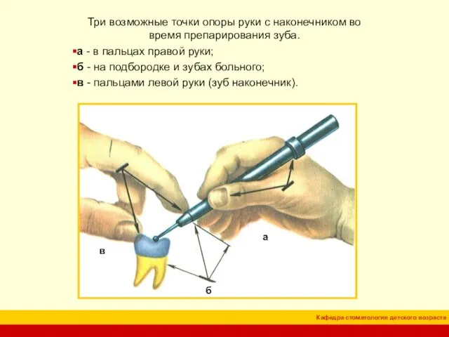 Три возможные точки опоры руки с наконечником во время препарирования зуба. а