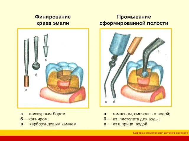 Финирование краев эмали Промывание сформированной полости а — фиссурным бором; б —