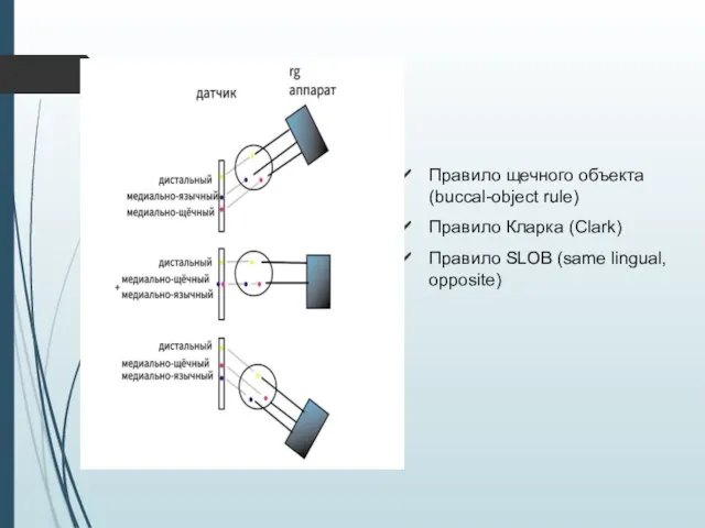 Правило щечного объекта (buccal-object rule) Правило Кларка (Clark) Правило SLOB (same lingual, opposite)