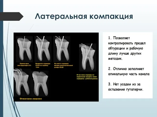 Латеральная компакция