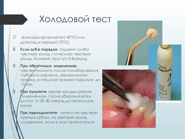 Холодовой тест Дихлордифторметан(-40°С) или диоксид углерода(-70°С). Если зуб в порядке пациент слабо