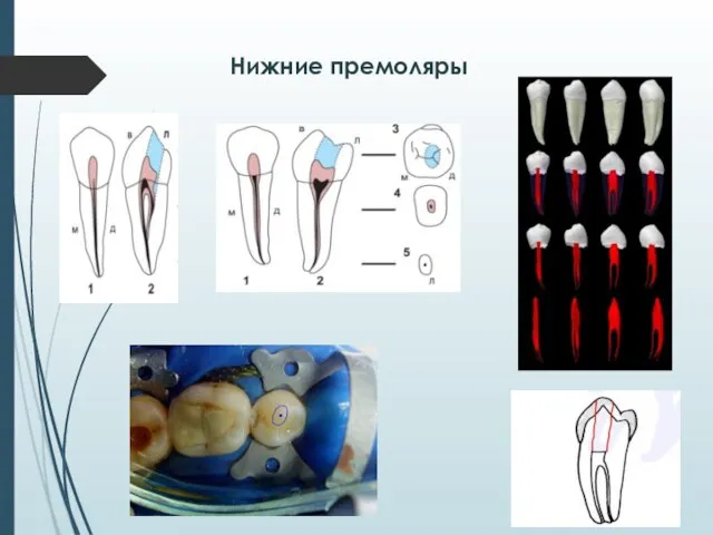 Нижние премоляры