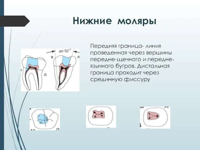 Нижние моляры Передняя граница- линия проведенная через вершины передне-щечного и передне-язычного бугров.