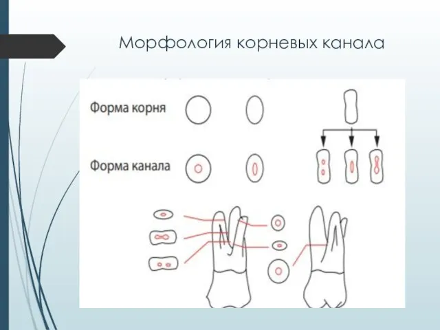 Морфология корневых канала