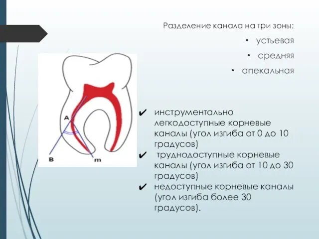 Разделение канала на три зоны: устьевая средняя апекальная инструментально легкодоступные корневые каналы