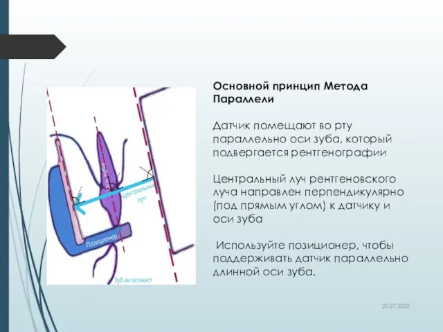 20.07.2022 Основной принцип Метода Параллели Датчик помещают во рту параллельно оси зуба,