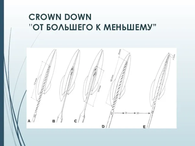 CROWN DOWN ”ОТ БОЛЬШЕГО К МЕНЬШЕМУ”