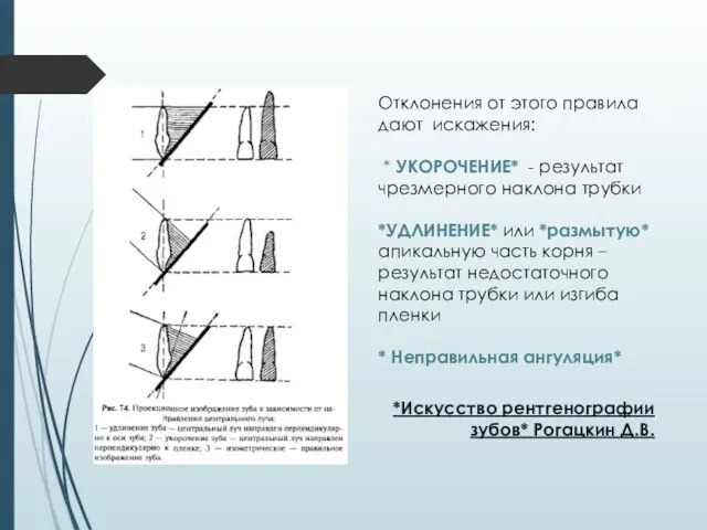 Отклонения от этого правила дают искажения: * УКОРОЧЕНИЕ* - результат чрезмерного наклона