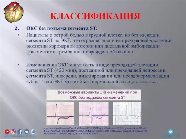 ОКС без подъема сегмента ST: Пациенты с острой болью в грудной клетке,