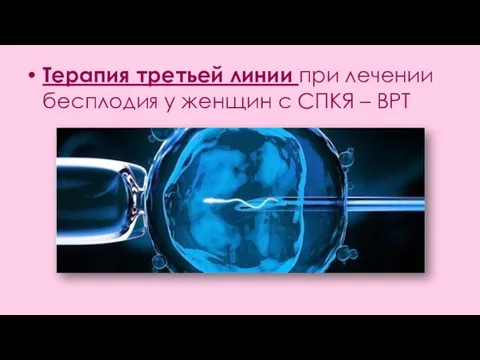 Терапия третьей линии при лечении бесплодия у женщин с СПКЯ – ВРТ