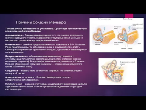 Причины болезни Меньера Точная причина заболевания не установлена. Существует несколько теорий возникновения