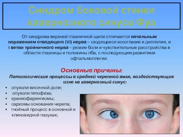 Синдром боковой стенки кавернозного синуса Фуа От синдрома верхней глазничной щели отличается