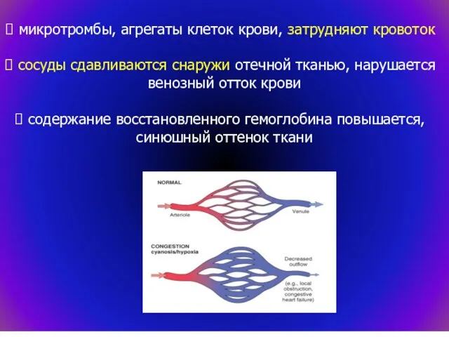 микротромбы, агрегаты клеток крови, затрудняют кровоток сосуды сдавливаются снаружи отечной тканью, нарушается