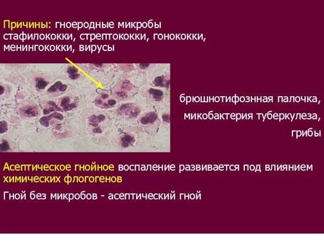 Причины: гноеродные микробы стафилококки, стрептококки, гонококки, менингококки, вирусы брюшнотифознная палочка, микобактерия туберкулеза,