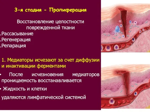 3-я стадия - Пролиферация Восстановление целостности поврежденной ткани Рассасывание Регенерация Репарация 1.