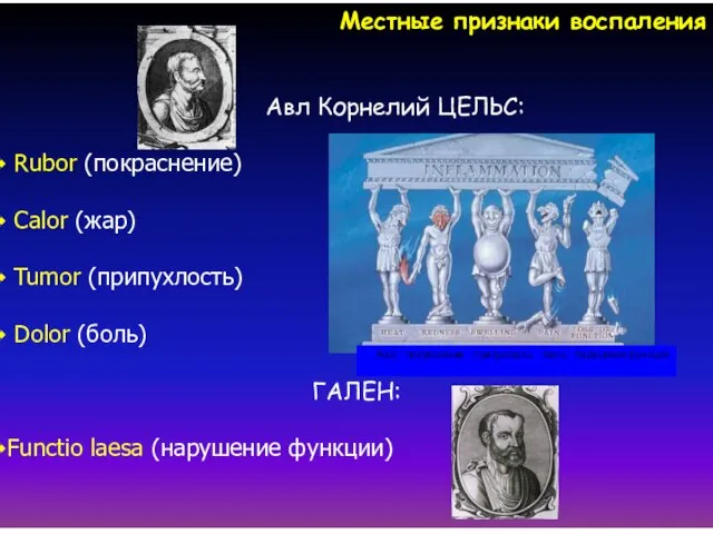 Местные признаки воспаления Авл Корнелий ЦЕЛЬС: Rubor (покраснение) Calor (жар) Tumor (припухлость)