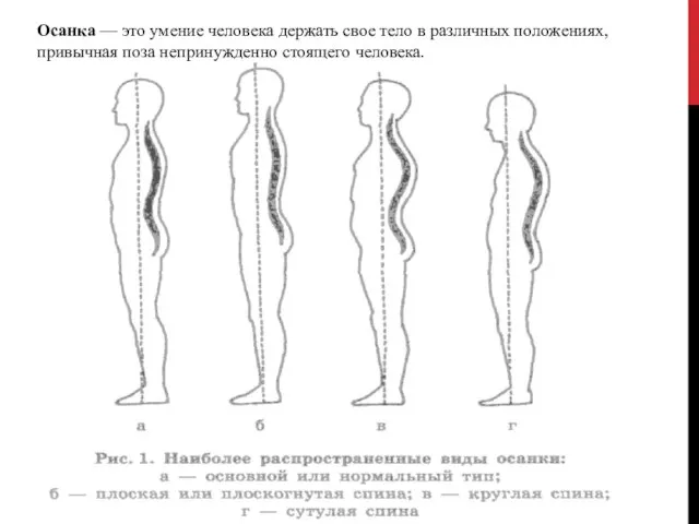 Осанка — это умение человека держать свое тело в различных положениях, привычная поза непринужденно стоящего человека.