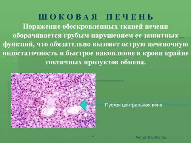 ШОК - ЭТО АКТИВНАЯ ЗАЩИТА ОРГАНИЗМА ОТ АГРЕССИИ СРЕДЫ Ш О К