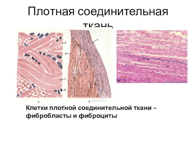 Плотная соединительная ткань Клетки плотной соединительной ткани – фибробласты и фиброциты