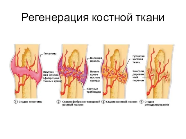 Регенерация костной ткани