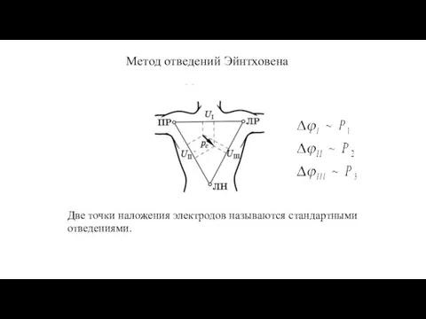 Метод отведений Эйнтховена Две точки наложения электродов называются стандартными отведениями.