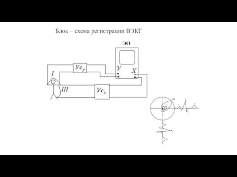 Блок – схема регистрации ВЭКГ