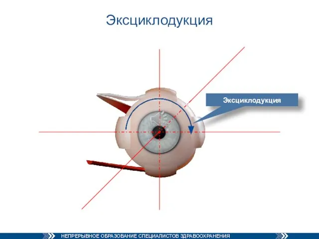 Эксциклодукция Эксциклодукция