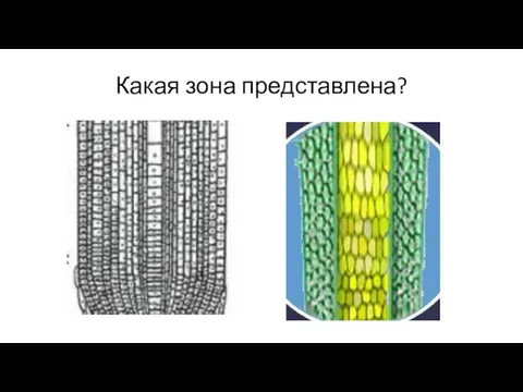 Какая зона представлена?