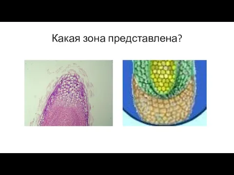 Какая зона представлена?