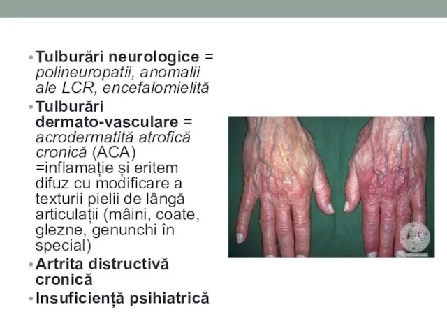 Tulburări neurologice = polineuropatii, anomalii ale LCR, encefalomielită Tulburări dermato-vasculare = acrodermatită
