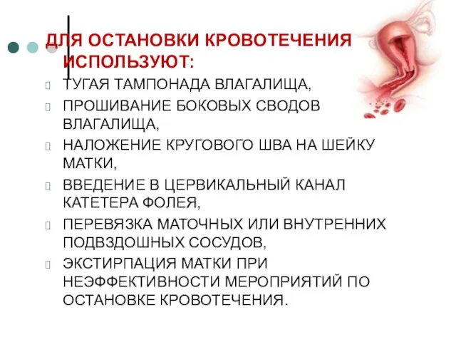 ДЛЯ ОСТАНОВКИ КРОВОТЕЧЕНИЯ ИСПОЛЬЗУЮТ: ТУГАЯ ТАМПОНАДА ВЛАГАЛИЩА, ПРОШИВАНИЕ БОКОВЫХ СВОДОВ ВЛАГАЛИЩА, НАЛОЖЕНИЕ