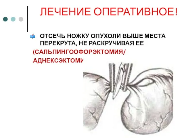 ЛЕЧЕНИЕ ОПЕРАТИВНОЕ! ОТСЕЧЬ НОЖКУ ОПУХОЛИ ВЫШЕ МЕСТА ПЕРЕКРУТА, НЕ РАСКРУЧИВАЯ ЕЕ (САЛЬПИНГООФОРЭКТОМИЯ/ АДНЕКСЭКТОМИЯ)