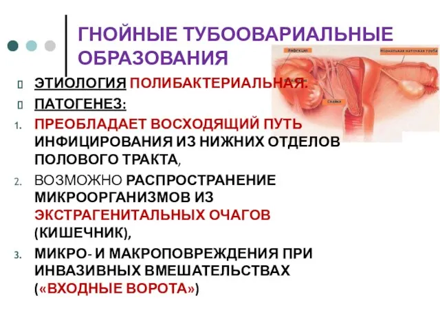 ГНОЙНЫЕ ТУБООВАРИАЛЬНЫЕ ОБРАЗОВАНИЯ ЭТИОЛОГИЯ ПОЛИБАКТЕРИАЛЬНАЯ. ПАТОГЕНЕЗ: ПРЕОБЛАДАЕТ ВОСХОДЯЩИЙ ПУТЬ ИНФИЦИРОВАНИЯ ИЗ НИЖНИХ