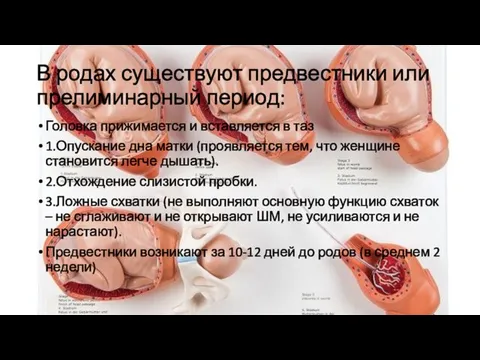 В родах существуют предвестники или прелиминарный период: Головка прижимается и вставляется в