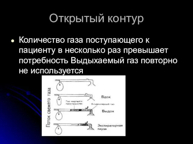 Открытый контур Количество газа поступающего к пациенту в несколько раз превышает потребность