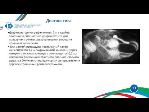 Диагностика Дакриоцисторинография может быть крайне полезной в диагностике дакриоцистита для выявления точного