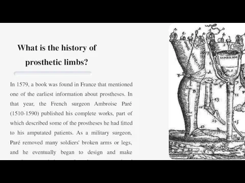 What is the history of prosthetic limbs? In 1579, a book was
