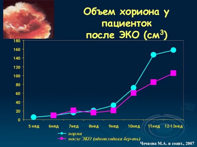 Объем хориона у пациенток после ЭКО (см3) Чечнева М.А. и соавт., 2007