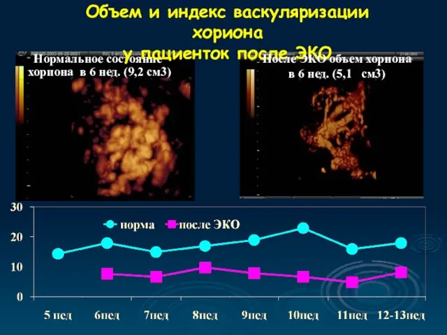 Нормальное состояние хориона в 6 нед. (9,2 см3) Объем и индекс васкуляризации