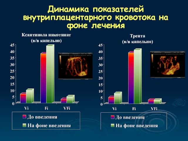 Динамика показателей внутриплацентарного кровотока на фоне лечения Ксантинола никотинат (в/в капельно) Трента (в/в капельно)