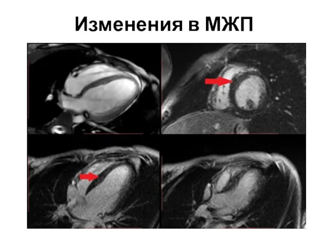 Изменения в МЖП