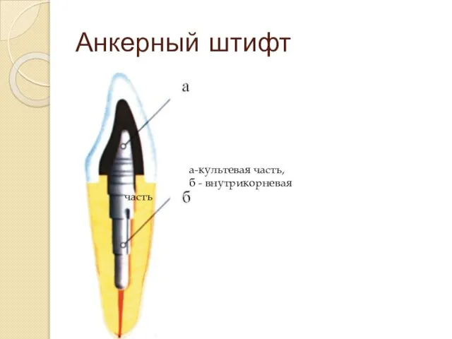 Анкерный штифт а-культевая часть, б - внутрикорневая часть